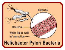 Heliobacter Pylori Bacteria